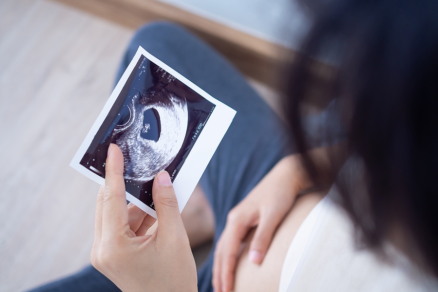 Pregnant woman looking at baby ultrasound scan and holding sonogram at home