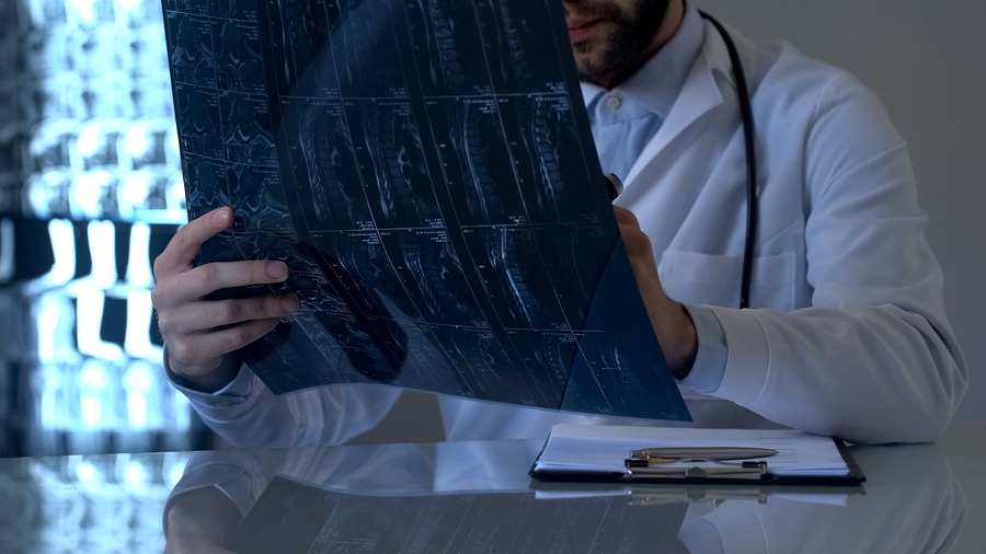 Doctor reviewing the spinal cord scans